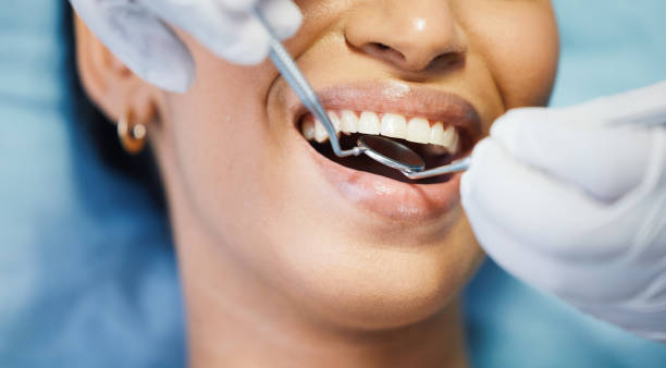 Teeth Whitening in NJ